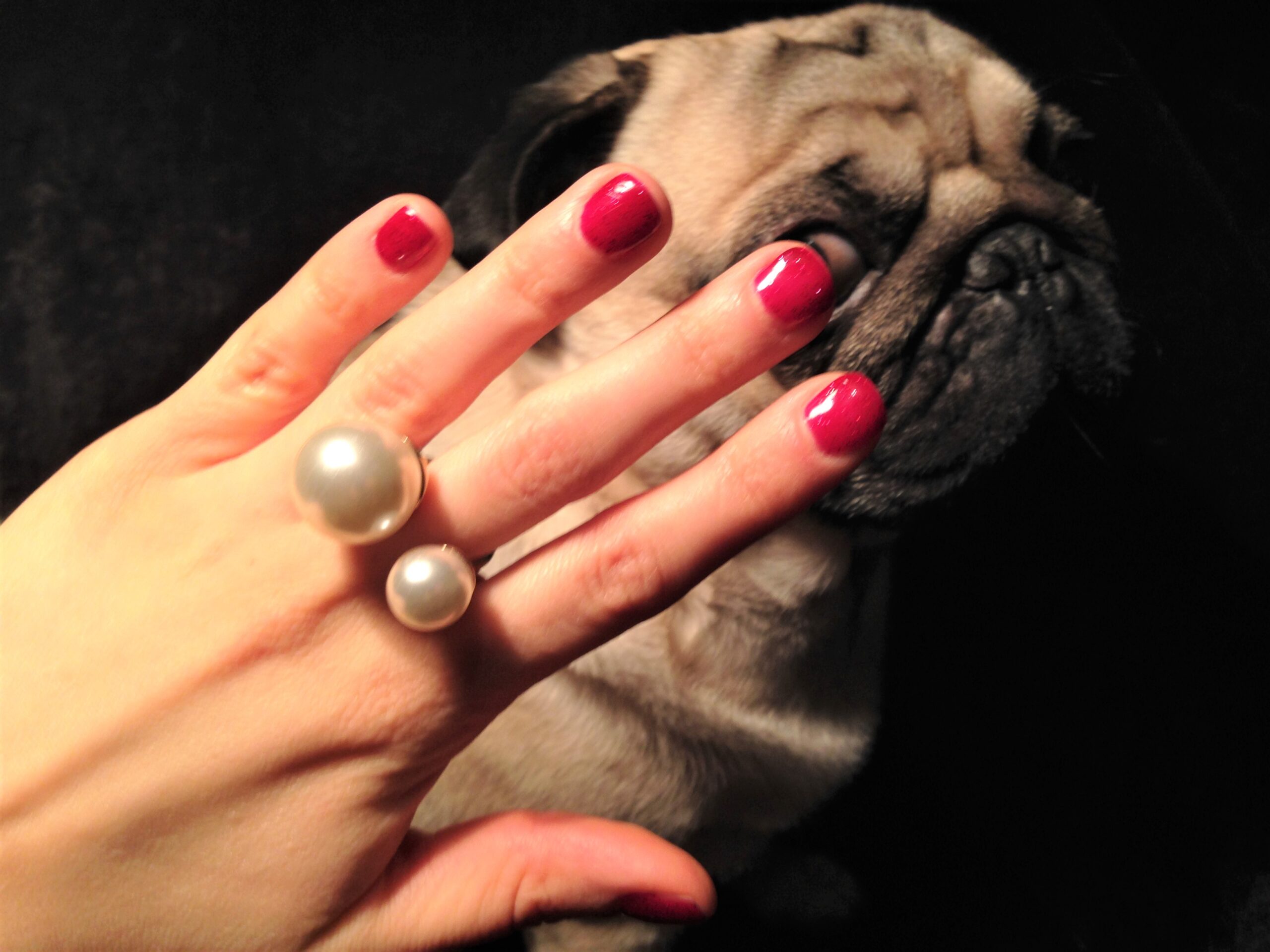 Nail biting - an innocent habit or a serious condition?